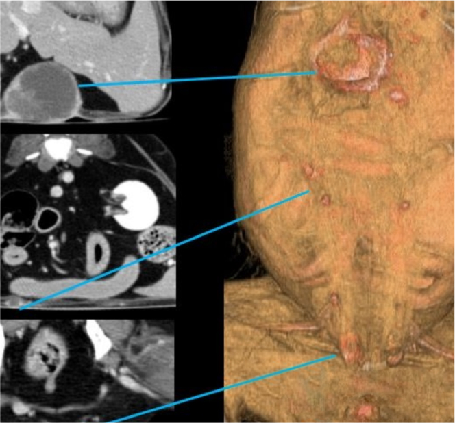 surgery_image