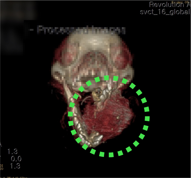 surgery_image