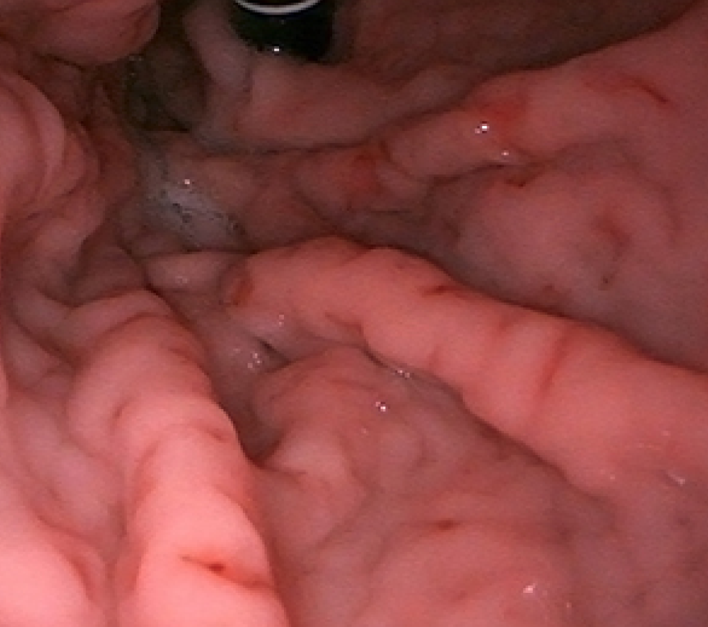 case10