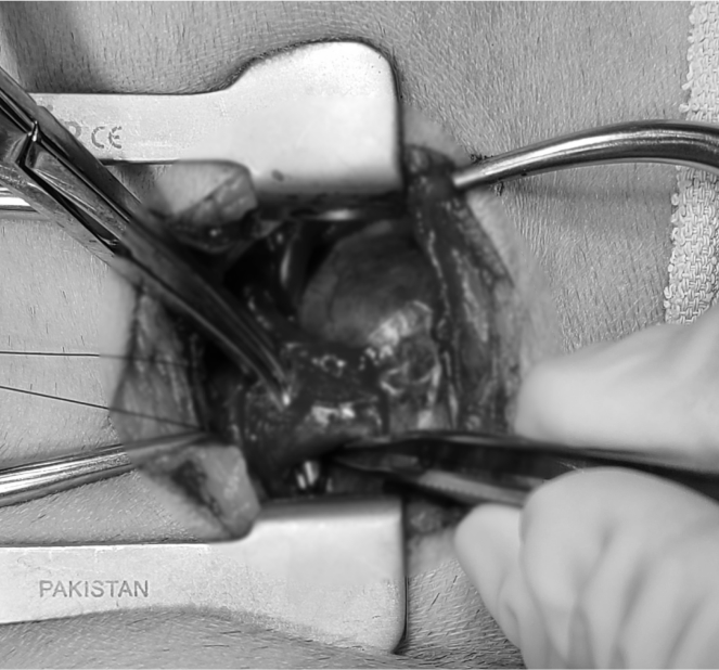 surgery_image